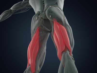 Hamstring injuries, sports physio belfast