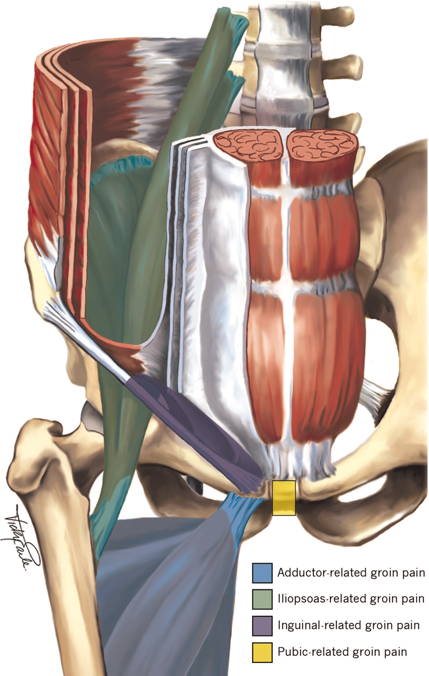 Gaelic football and hurling groin injuries, sports physio belfast